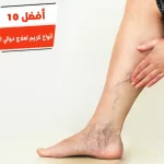 أفضل 10 أنواع كريم لعلاج دوالي الساقين في مصر