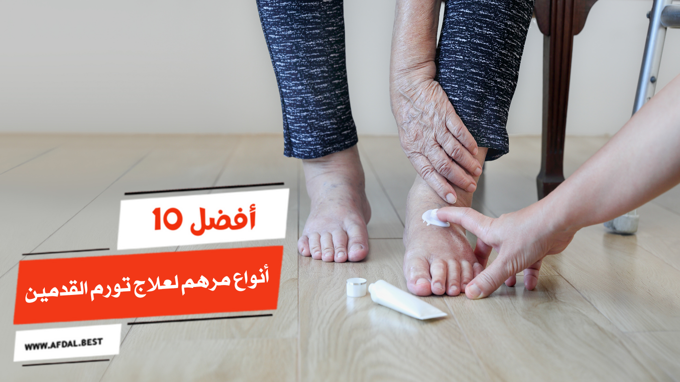 أفضل 10 أنواع مرهم لعلاج تورم القدمين
