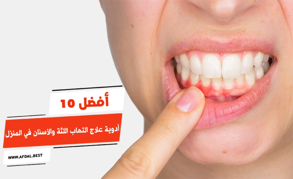 أفضل 10 أدوية علاج التهاب اللثة والأسنان في المنزل
