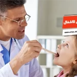 أفضل 10 أدوية علاج فطريات الفم للاطفال