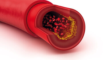 تقليل نسب الكوليسترول في الدم